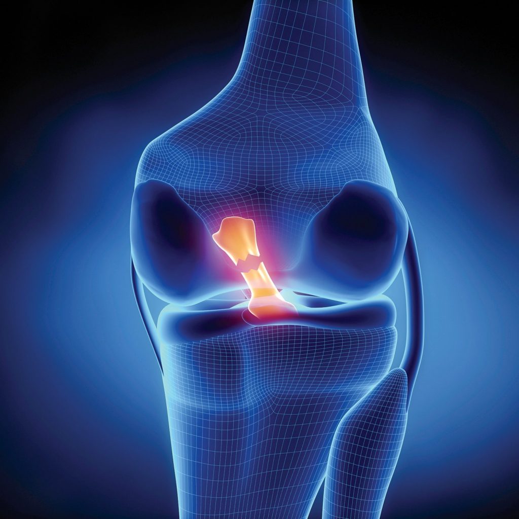 Knee Surgery Sports Traumatology Arthroscopy